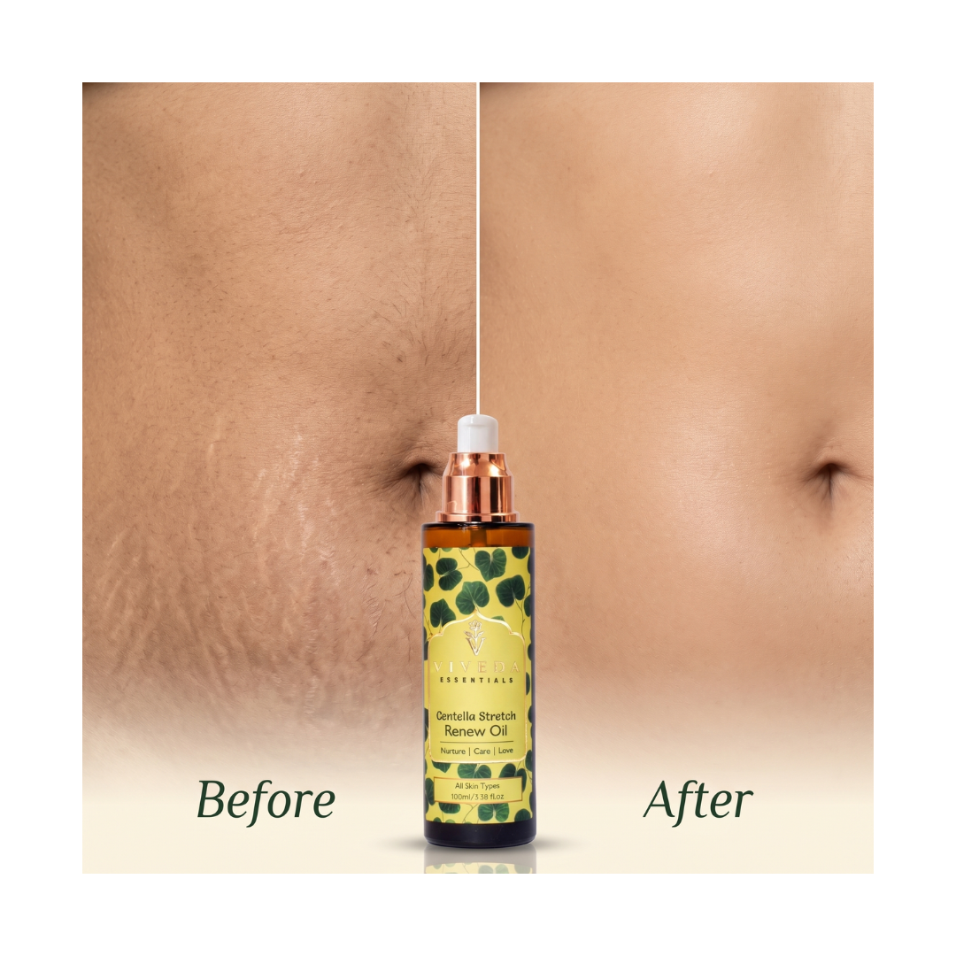 Centella Stretch Renew Oil
